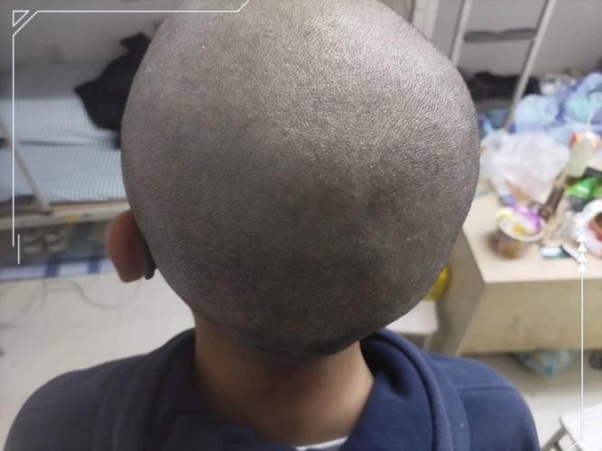 剃光头的好处 白发多剃光头的好处